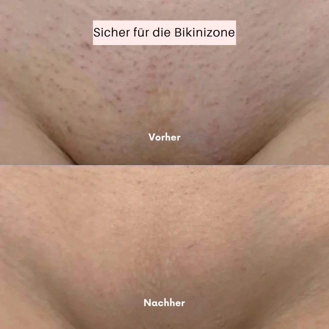 BayaShaver - Der ultimative 2-in-1 Körperrasierer