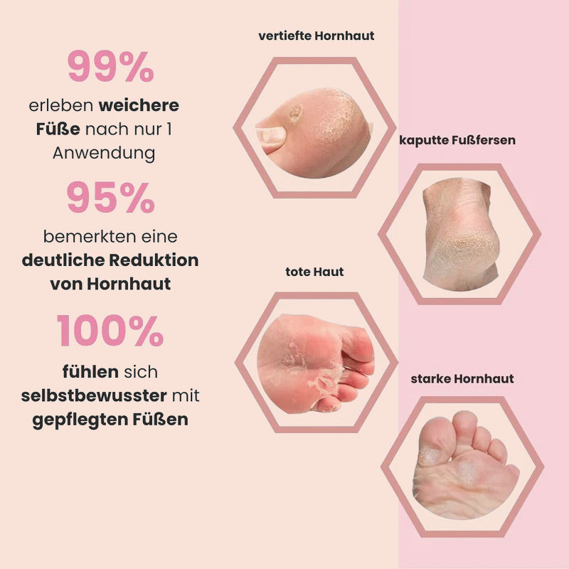 BayaGlide Pro - inkl. 60 Glide Pads (Gratis)