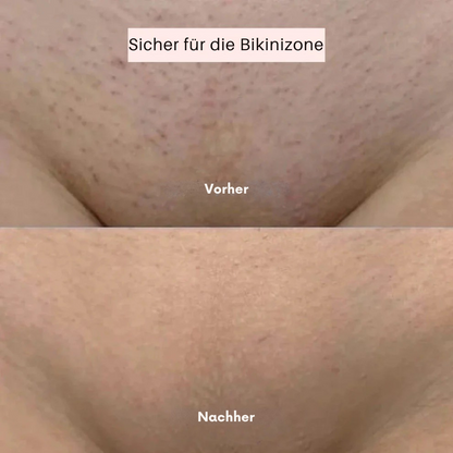 BayaShaver - Der ultimative 2-in-1 Körperrasierer