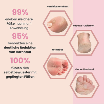 BayaGlide Pro -  inkl. 60 Glide Pads (Gratis)
